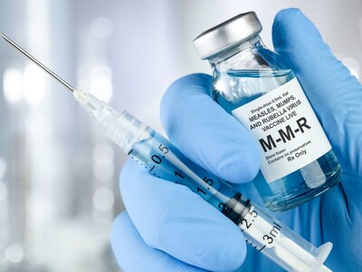 State Confirms Single Measles Case, Urges Vaccination and Vigilance