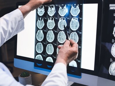 Morris County Neurologist Temporarily Suspended, Allegedly Violated Prior Sexual Misconduct Order