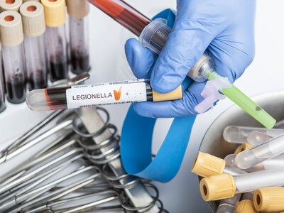 Unusual Spike in Legionnaires’ Disease Prompts NJ Health Investigation in Middlesex and Union Counties