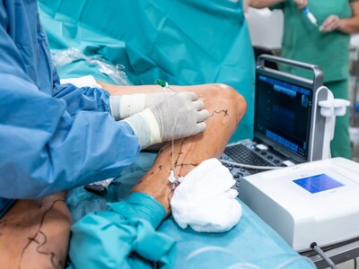 Essex County Surgeon Agrees to Seven-Year License Suspension Over Alleged Harmful Vascular Procedures