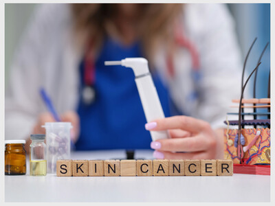 Free Skin Cancer Screening