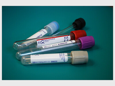 SMAC Blood Testing Program